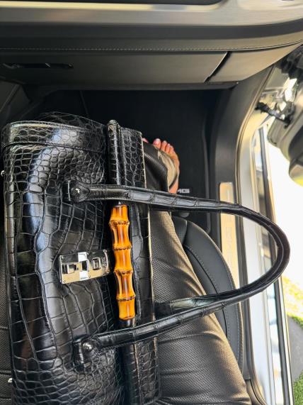 Kylie Jenner kožno 4.jpg